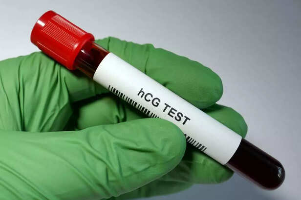 hCG TEST