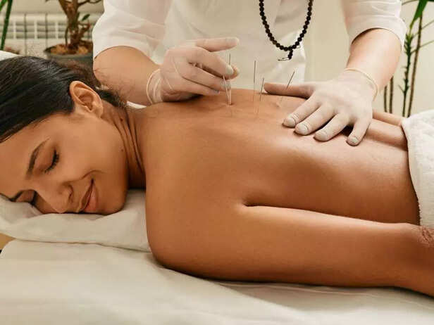 Consider Acupuncture