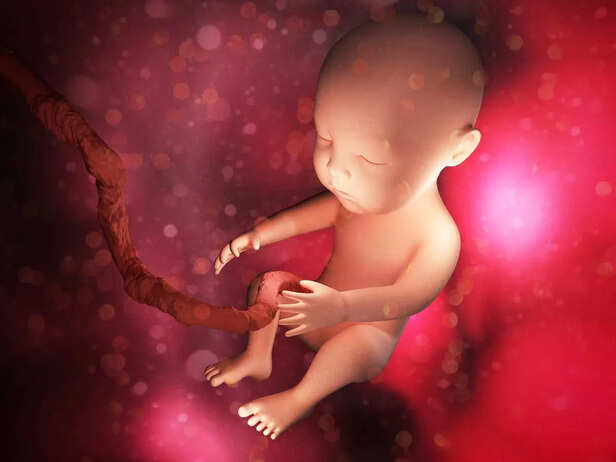 fetus with long limbs