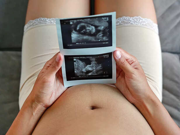 mother looking at anomaly scan