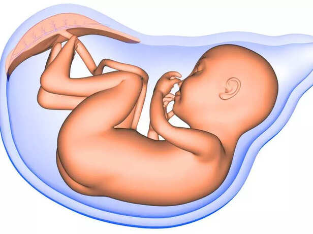 NAIL FORMATION IN FETUS