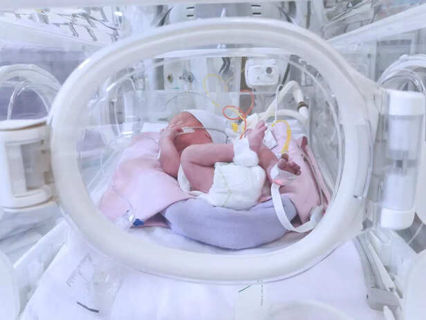 Premature child in NICU