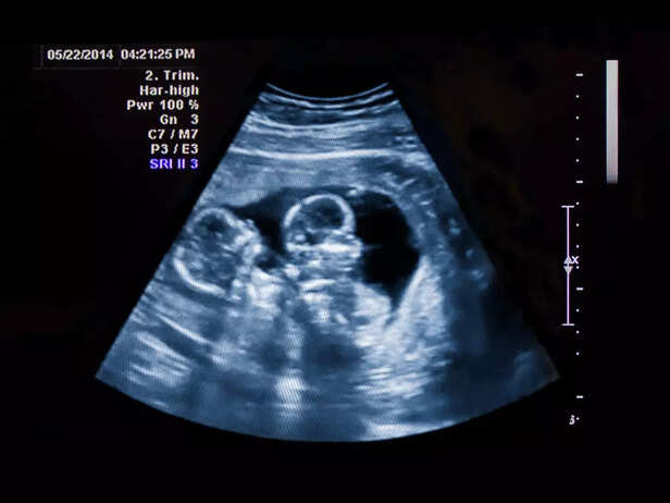 twin ultrasound