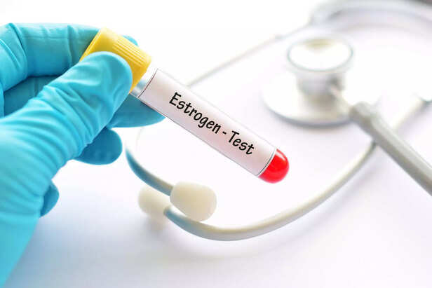 Estrogen hormone test