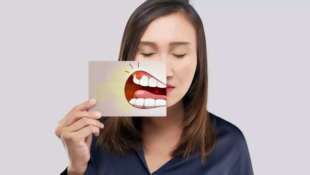 Pregnancy Gingivitis