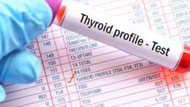 Thyroid Function Tests