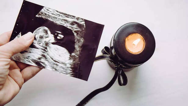 Preterm Birth Prevention