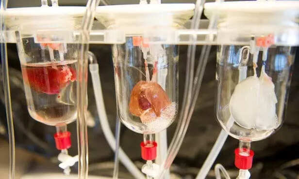 Artificial Organs Grown in Labs (Image credit- The New York Times)