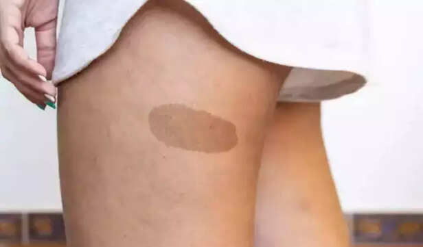 The Seat of Sensual Karma