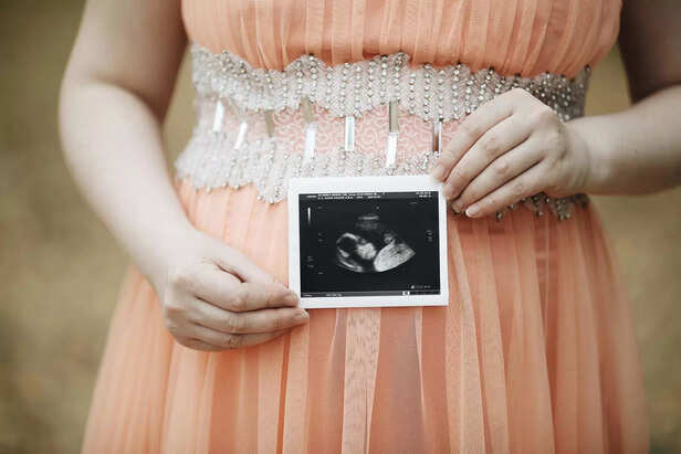 Pregnant woman