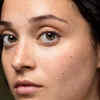 mole on face