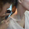 moles on reveling parts