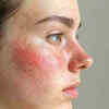 side effects by skin type(image credit:freepik)