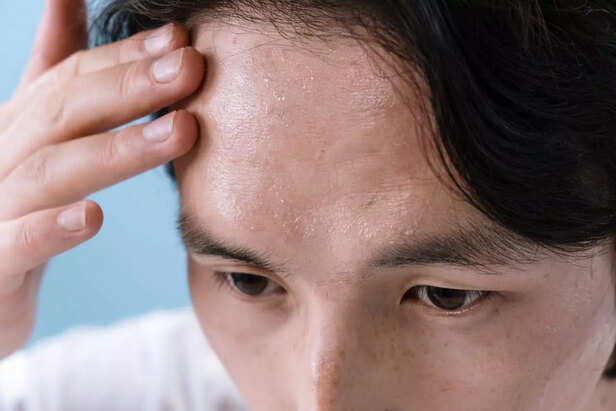 How humidity affects the skin