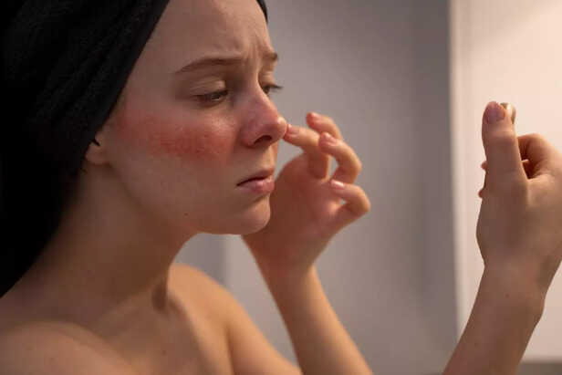 Destroyed skin