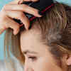itchy scalp due to chemicals