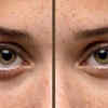 freckles vs pigmentation(image credit:freepik)