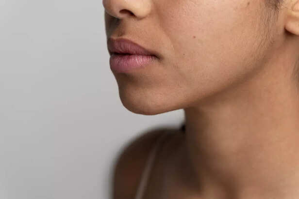Dry skin