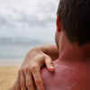 Why SPF is a Daily Essential