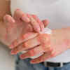 Importance of Ceramides in Skin Barrier