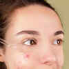 Niacinamide suits every skin type.