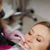 Dental Makeovers in India