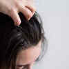 Healthy Scalp, Balanced Microbiome
