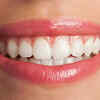 Lasting Smiles Take Effort