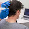 Professional Scalp Scan