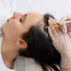 PRP THERAPY - Natural Hair Regrowth Treatment