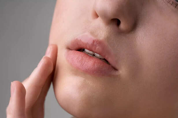 Dry lips