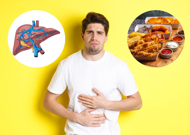 Fatty Liver Risk