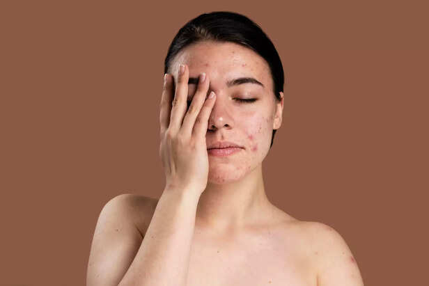 Harmful effect on skin