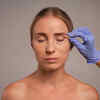 Under Eye Fillers