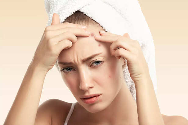 Skin pores