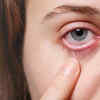 Red Eyes
