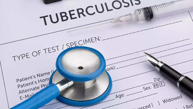 364218-tuberculosis-tb-symptoms-causes-treatment-infection-chest-pain-coughing-up-blood-feeling-tired-all-the-time-night-sweats-chi-2