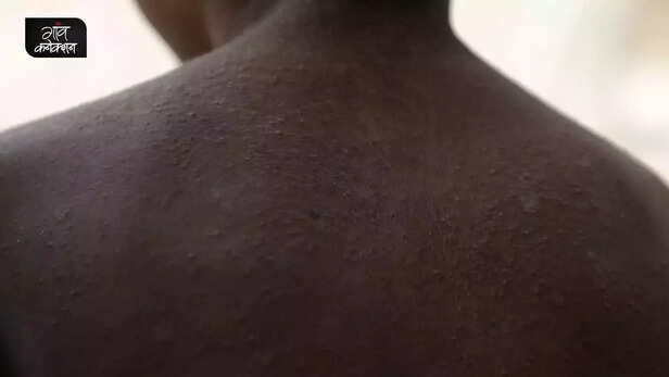 360232-heat-wave-rural-india-daily-wagers-farm-labourers-health-job-loss-heat-stroke