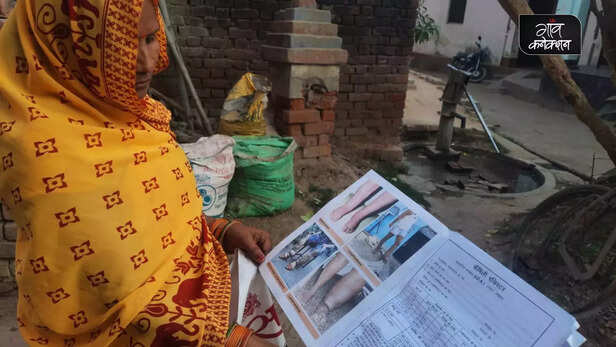 364424-filaria-uttar-pradesh-lymphatic-filariasis-elephantiasis-hathi-paon-awareness-campaign-uttar-pradesh-health-12