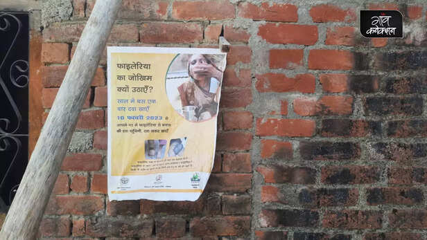 364426-filaria-uttar-pradesh-lymphatic-filariasis-elephantiasis-hathi-paon-awareness-campaign-uttar-pradesh-health-10