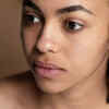Pigmentation