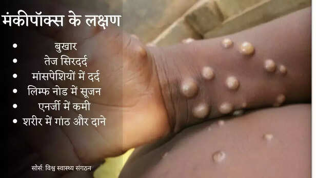 359766-monkeypox-outbreak-2022-causes-symptoms-treatment-infection-world-health-organization-4