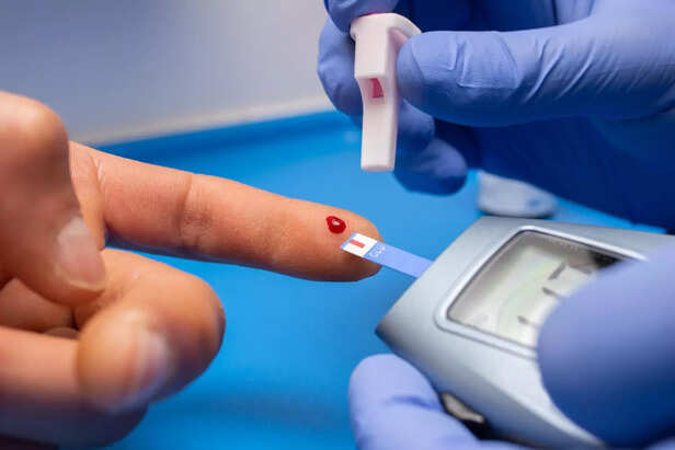Blood Sugar Testing