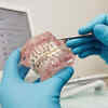 Pro's of braces