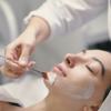 chemical peel
