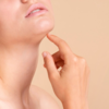 chin liposuction