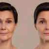 Mewing before and after