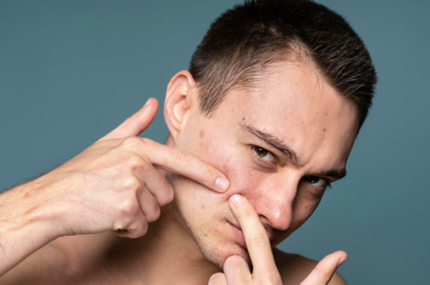 popping pimples