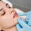practitioners increasingly tailoring lip augmentations