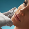 lip filler injection